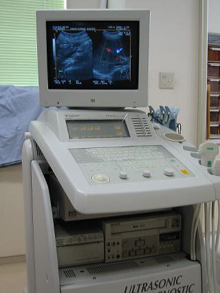 腹部超音波検査装置